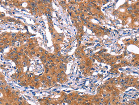 IRS1 Polyclonal Antibody Store at -20°C - MSE Supplies LLC