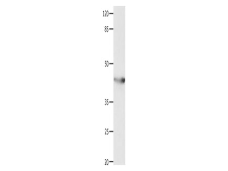 KCNA5 Polyclonal Antibody Store at -20°C - MSE Supplies LLC