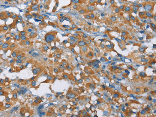 KLF7 Polyclonal Antibody Store at -20°C - MSE Supplies LLC