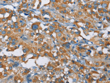 KLF7 Polyclonal Antibody Store at -20°C - MSE Supplies LLC