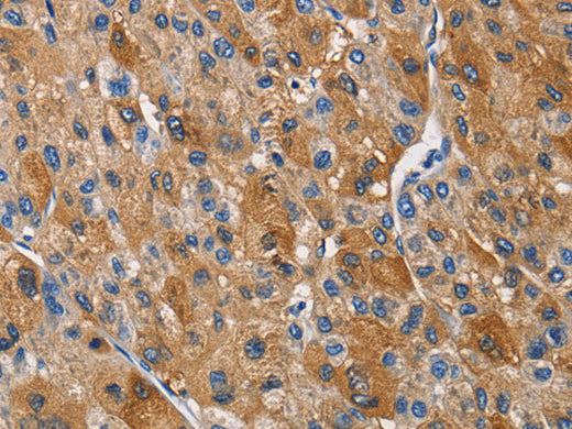 KLK1 Polyclonal Antibody Store at -20°C - MSE Supplies LLC