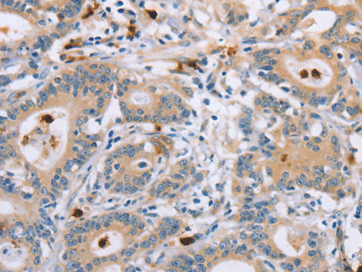 KLK4 Polyclonal Antibody Store at -20°C - MSE Supplies LLC