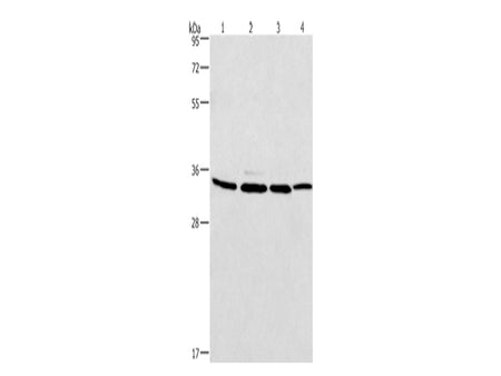 MAD2L1BP Polyclonal Antibody Store at -20°C - MSE Supplies LLC