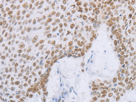 MCM2 Polyclonal Antibody Store at -20°C - MSE Supplies LLC