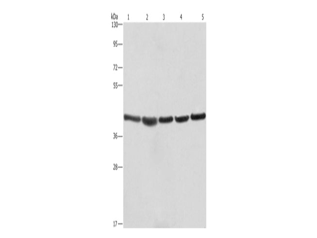 RPSA Polyclonal Antibody Store at -20°C - MSE Supplies LLC