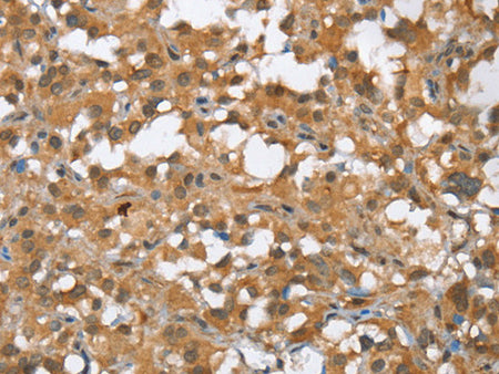 MMP12 Polyclonal Antibody Store at -20°C - MSE Supplies LLC