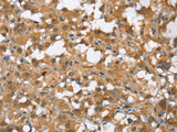 MMP12 Polyclonal Antibody Store at -20°C - MSE Supplies LLC