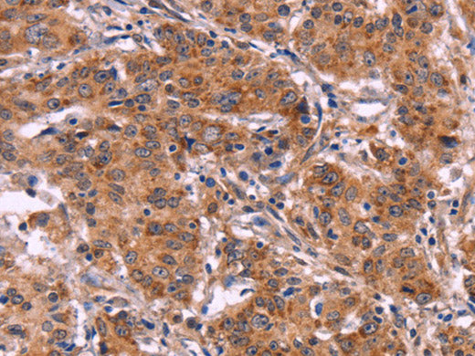 MMP14 Polyclonal Antibody Store at -20°C - MSE Supplies LLC