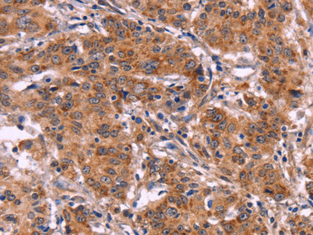 MMP14 Polyclonal Antibody Store at -20°C - MSE Supplies LLC
