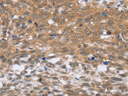 MLH1 Polyclonal Antibody Store at -20°C - MSE Supplies LLC