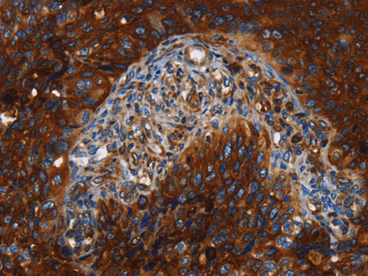 MSLN Polyclonal Antibody Store at -20°C - MSE Supplies LLC