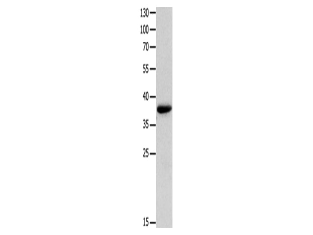 MYOZ1 Polyclonal Antibody Store at -20°C - MSE Supplies LLC