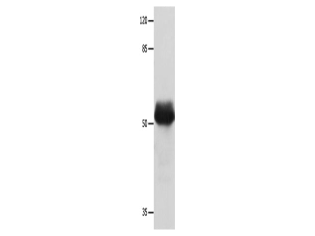 MUTYH Polyclonal Antibody Store at -20°C - MSE Supplies LLC
