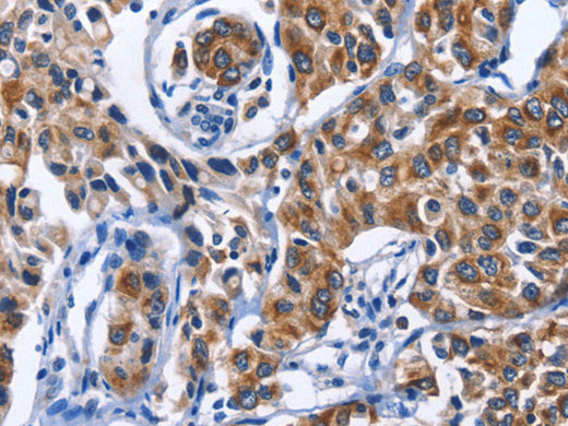 MYH1 Polyclonal Antibody Store at -20°C - MSE Supplies LLC
