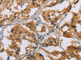 NRN1 Polyclonal Antibody Store at -20°C - MSE Supplies LLC