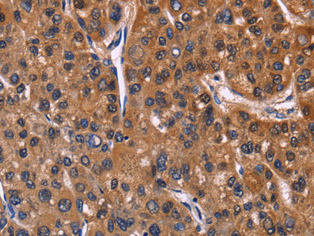 NFATC3 Polyclonal Antibody Store at -20°C - MSE Supplies LLC
