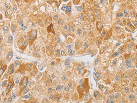 NGF Polyclonal Antibody Store at -20°C - MSE Supplies LLC