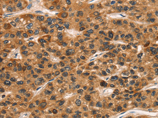CD159a/c Polyclonal Antibody Store at -20°C - MSE Supplies LLC