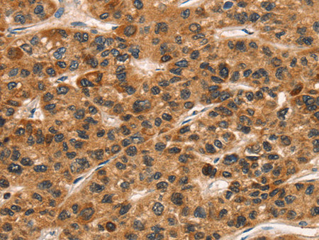CD159a/c Polyclonal Antibody Store at -20°C - MSE Supplies LLC