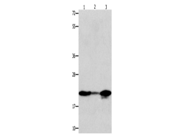 NME1 Polyclonal Antibody Store at -20°C - MSE Supplies LLC
