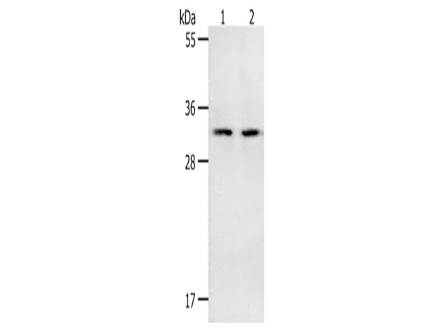 NME6 Polyclonal Antibody Store at -20°C - MSE Supplies LLC