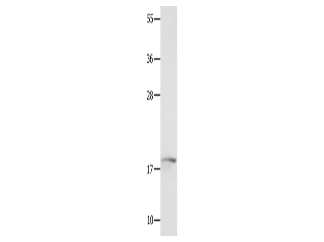 NME3 Polyclonal Antibody Store at -20°C - MSE Supplies LLC