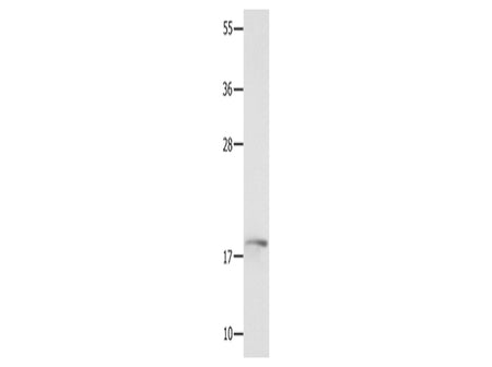 NME3 Polyclonal Antibody Store at -20°C - MSE Supplies LLC