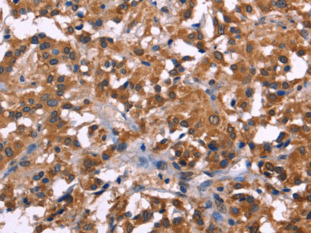NOS2 Polyclonal Antibody Store at -20°C - MSE Supplies LLC