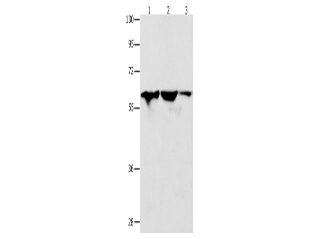 DNAJC7 Polyclonal Antibody Store at -20°C - MSE Supplies LLC