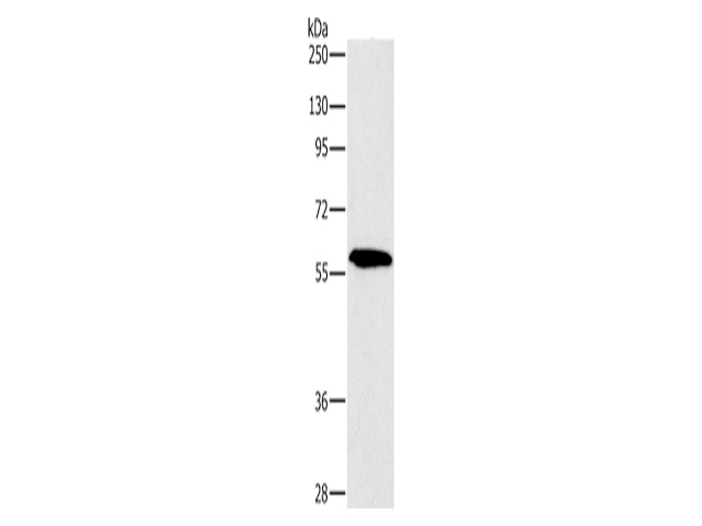 PAK2 Polyclonal Antibody Store at -20°C - MSE Supplies LLC