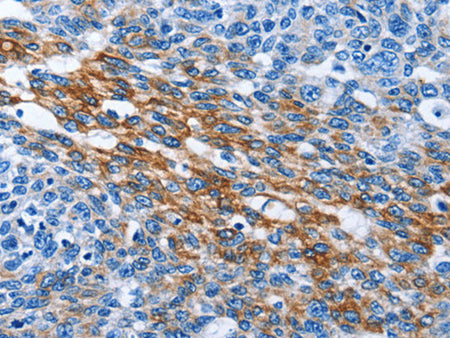 PAK6 Polyclonal Antibody Store at -20°C - MSE Supplies LLC