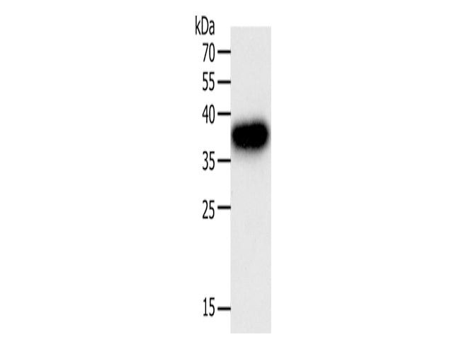 PLAUR Polyclonal Antibody Store at -20°C - MSE Supplies LLC