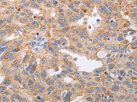 PPP1CB Polyclonal Antibody Store at -20°C - MSE Supplies LLC