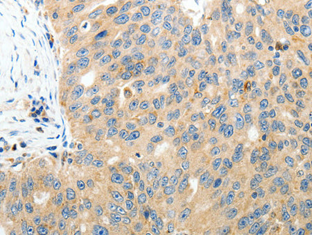 RAMP3 Polyclonal Antibody Store at -20°C - MSE Supplies LLC