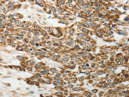 E-Selectin Polyclonal Antibody Store at -20°C - MSE Supplies LLC