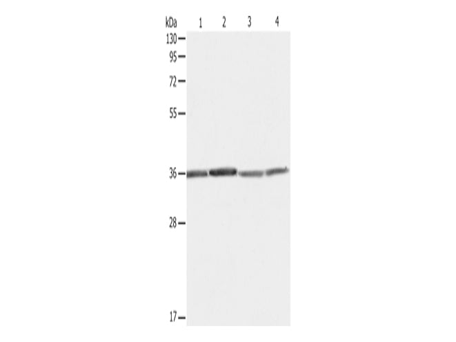RPLP0 Polyclonal Antibody Store at -20°C - MSE Supplies LLC