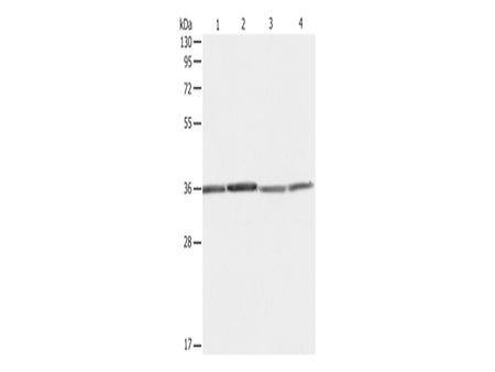 RPLP0 Polyclonal Antibody Store at -20°C - MSE Supplies LLC