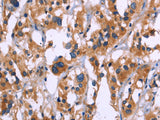 ZEB2 Polyclonal Antibody Store at -20°C - MSE Supplies LLC