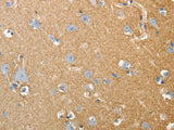 SLC4A4 Polyclonal Antibody Store at -20°C - MSE Supplies LLC