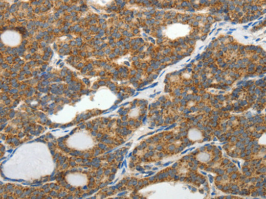 SLC12A4 Polyclonal Antibody Store at -20°C - MSE Supplies LLC