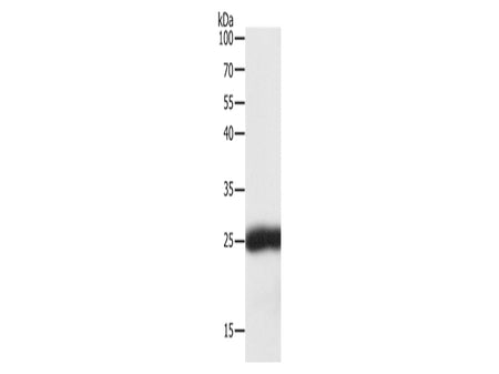 SNAP25 Polyclonal Antibody Store at -20°C - MSE Supplies LLC