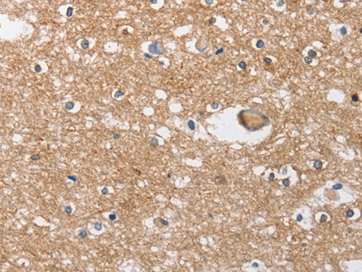 SOCS2 Polyclonal Antibody Store at -20°C - MSE Supplies LLC
