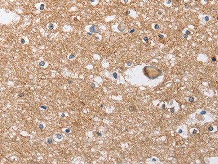 SOCS2 Polyclonal Antibody Store at -20°C - MSE Supplies LLC