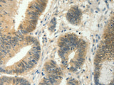 SOCS5 Polyclonal Antibody Store at -20°C - MSE Supplies LLC