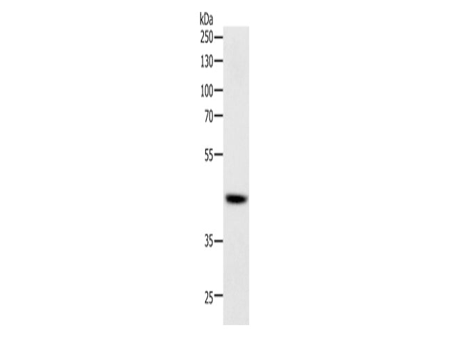 SOX-7 Polyclonal Antibody Store at -20°C - MSE Supplies LLC