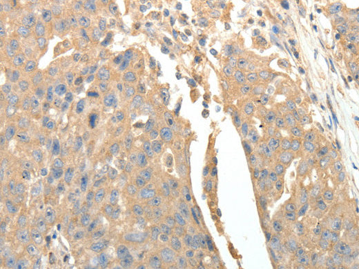 SFTPD Polyclonal Antibody Store at -20°C - MSE Supplies LLC