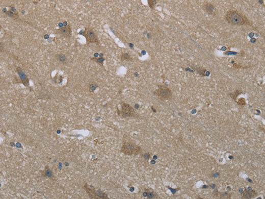 SYT3 Polyclonal Antibody Store at -20°C - MSE Supplies LLC