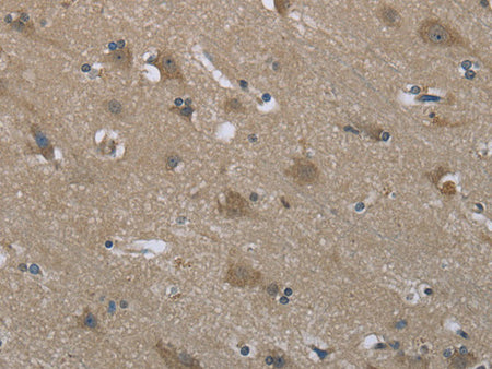 SYT3 Polyclonal Antibody Store at -20°C - MSE Supplies LLC