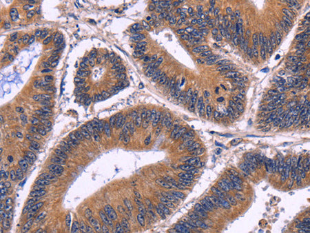 SPATA7 Polyclonal Antibody Store at -20°C - MSE Supplies LLC