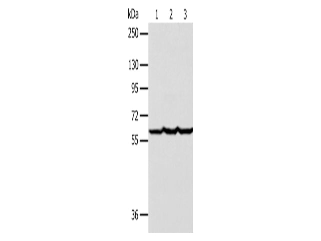 Factor IX Polyclonal Antibody Store at -20°C - MSE Supplies LLC